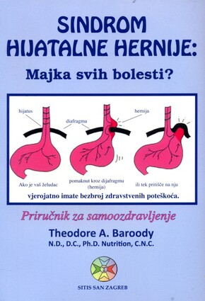 Sindrom hijatalne hernije
