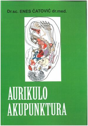 Aurikulo