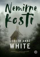 Nemirne kosti